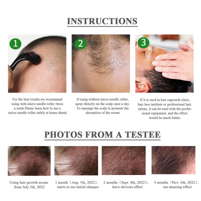 식물성 추출품 맞춤 피부 관리 제품 자연 머리카락 성장 세럼 80ML 빠른 효과 위대한 바겐 공장 공급 0