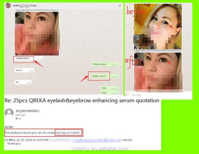 바이오 효소 눈꺼풀 성장 세럼의 사용 기간 3 년 2
