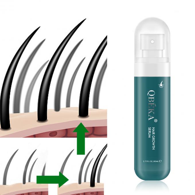 80ml 헤어 성장 오일 개인 레이블 제품 전문 QC 팀 탈모 방지 세럽 0