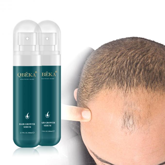 80ml 헤어 성장 오일 개인 레이블 제품 전문 QC 팀 탈모 방지 세럽 2