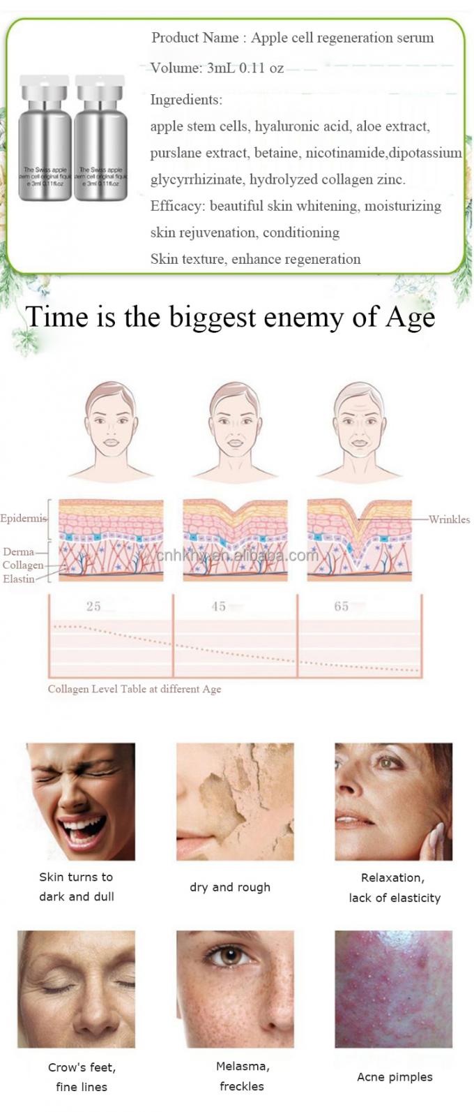 노화 방지 및 주름 방지 치료용 에무 기름 함유 스위스 사과 줄기 세포 세움 3